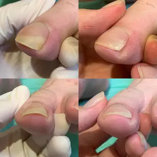 ネイル 東京巻き爪アカデミー所属・東京巻き爪 アカデミーのエステ・リラクイメージ