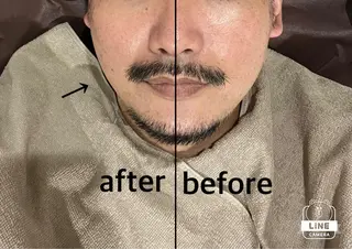 脱毛/痩身/頭皮ケア GLYCINEのエステ・リラクイメージ