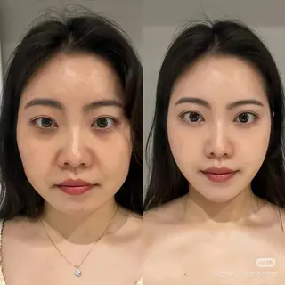 ネイル aliaハイフ&水光ジェットサロン所属・aliaハーブ水光店 エステティシャン募集のエステ・リラクイメージ