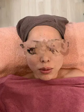 ボディ&フェイシャルサロン Vierouge所属・肌質改善・美肌サロン ヴィエルージュのエステ・リラクイメージ