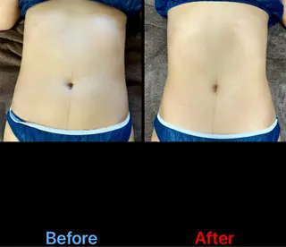 lumirise viblissのエステ・リラクイメージ