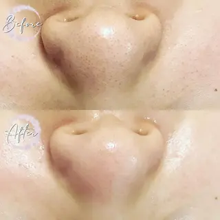 まつ毛パーマ・美肌 ナチュラル　ボーテのマツエク・マツパデザイン