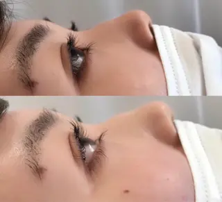 マツエク・マツパ まつげ、毛穴 TREEのエステ・リラクイメージ