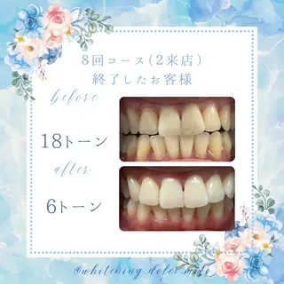 セルフホワイトニング Dolce八王子店のその他イメージ