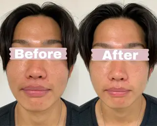 藤本 真心のネイルデザイン