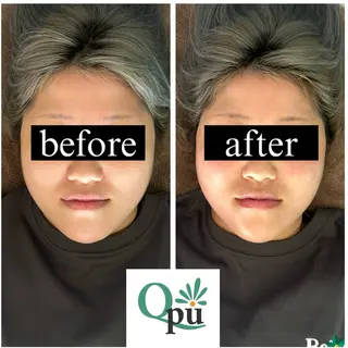 Qpu(キュープ)下北沢店所属・鮎川 さゆりのエステ・リラクイメージ