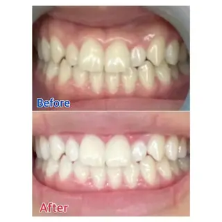 M渋谷店所属・Ｍ渋谷 ホワイトニングのエステ・リラクイメージ