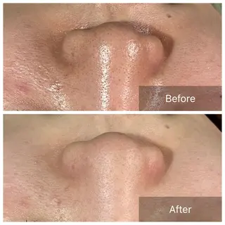 Laki  ドライヘッドスパ&ライトエステ所属・Laki  毛穴ケア とヘッドスパのサロンのエステ・リラクイメージ