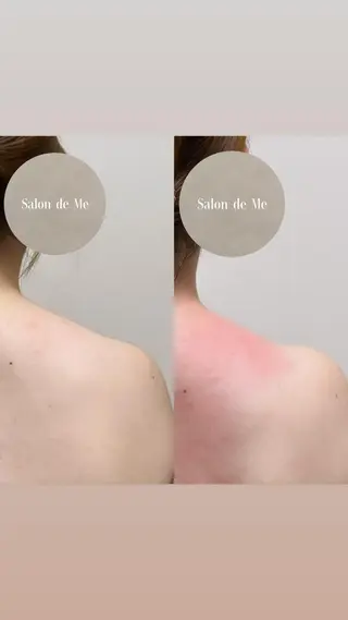 Salon de Me所属・💫Salon de Me💫予約停止中のエステ・リラクイメージ