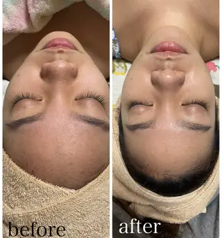 Daisy ~Beauty care by DANA~所属・ハーブピーリング🌿 danaのエステ・リラクイメージ