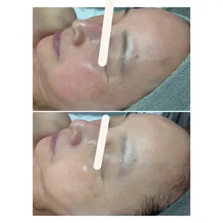 L.L.C所属・〜L.L.C〜 阿波座,中之島のエステ・リラクイメージ