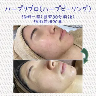 Laplace池袋本店(ラプラス池袋本店)所属・Laplace 池袋本店のその他イメージ