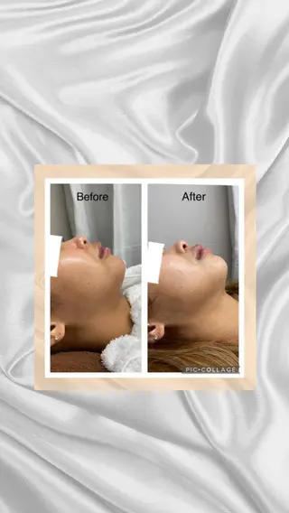 ENCHANT 脱毛.小顔.毛穴のエステ・リラクイメージ