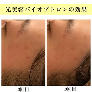 Bellesthe （ベルエステ）のエステ・リラクイメージ