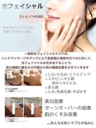 VIERU YURIのネイルデザイン