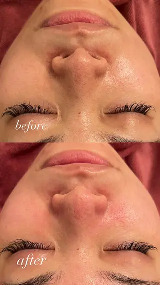 肌管理サロン neoriiのその他イメージ