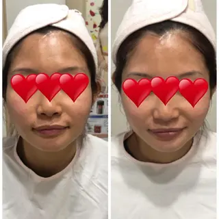 メナード　フェイシャルサロン　鳥飼野々店所属・石川 捺季のエステ・リラクイメージ