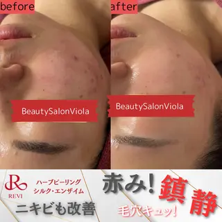 Beauty SalonViolaのエステ・リラクイメージ