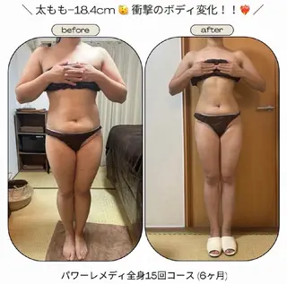 biloop所属・《痩身×疲労改善》 BILOOPのエステ・リラクイメージ