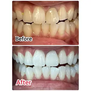 プラチナムビューティー柏所属・【歯科提携】柏ホワイ トニングスタイルのその他イメージ