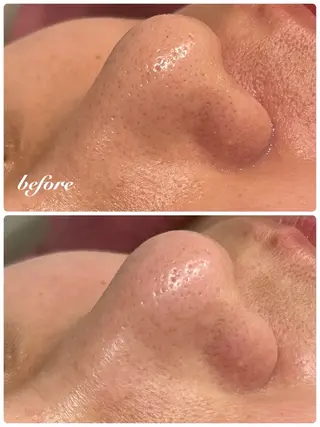 アンシャンテ トータルビューティーのエステ・リラクイメージ