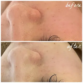 メンズ メナード岐阜茜部 杉浦のエステ・リラクイメージ