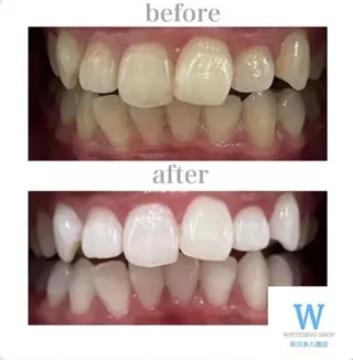 ホワイトニング ショップ本八幡店のエステ・リラクイメージ