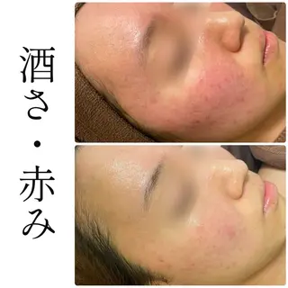 ハーブピーリング専門 BIOEL横浜のエステ・リラクイメージ