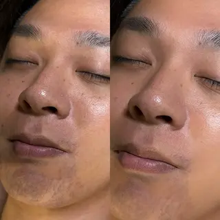 六本木脱毛andS 店長Sachiのエステ・リラクイメージ