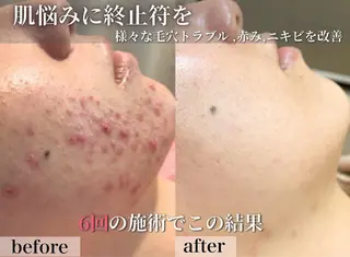 フェイシャル/脱毛 ジョアアンジェ小夷のエステ・リラクイメージ