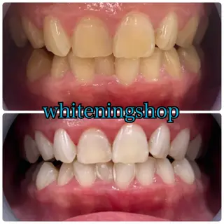 メンズ ホワイトニング ショップ川越店のエステ・リラクイメージ