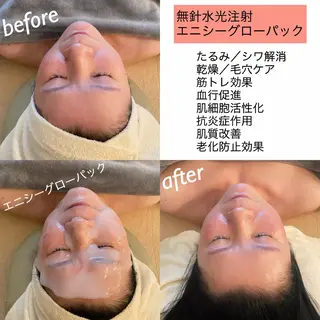 うなじ脱毛/美肌脱毛 LABELのエステ・リラクイメージ