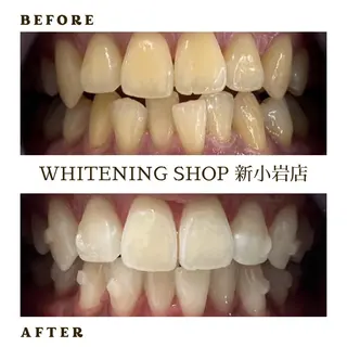 メンズ ホワイトニング ショップ新小岩店のその他イメージ