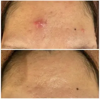 夏までに肌荒れ卒業 するサロン🌻のエステ・リラクイメージ