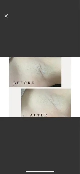 Its Yoshikaのエステ・リラクイメージ