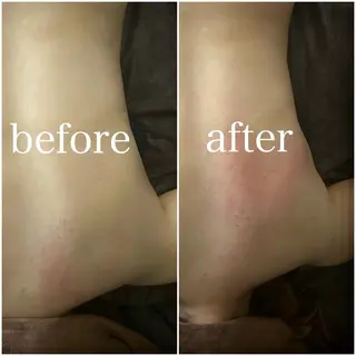 PIUMA 筋膜リリース・リンパのエステ・リラクイメージ