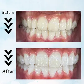 セルフホワイトニング エクシア塩釜口駅前店所属・セルフホワイトニング エクシア塩釜口駅前店のその他イメージ