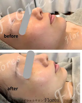 Flores所属・Flores- フローレスのエステ・リラクイメージ