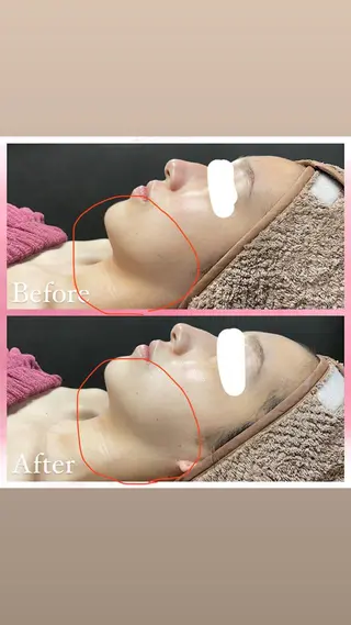 salon〜RePCa〜(サロンルピカ)所属・山﨑 藍のエステ・リラクイメージ