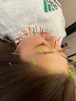 美容鍼灸整体サロンBeauJu所属・小顔矯/美容鍼/鍼灸 BeauJuのその他イメージ