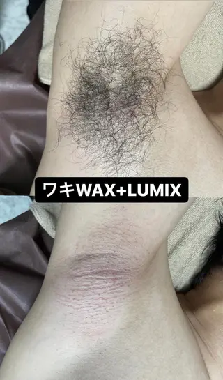 メンズ キッズ Epina 千葉店 【エピナ】のエステ・リラクイメージ