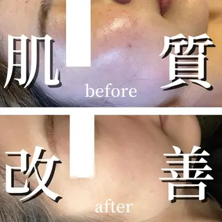 小顔サロン AMYONのエステ・リラクイメージ