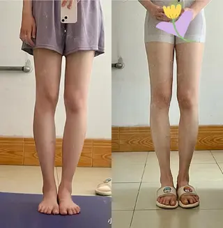 aliaハイフ&水光ジェットサロン所属・aliaハーブ水光店 エステティシャン募集のエステ・リラクイメージ