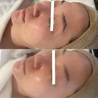 中目黒ハーブピーリン グ🌿ララピールのエステ・リラクイメージ