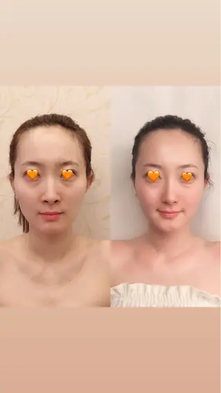 angeailes 小顔矯正サロンのエステ・リラクイメージ