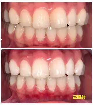 LOVE ホワイトニング渋谷のその他イメージ