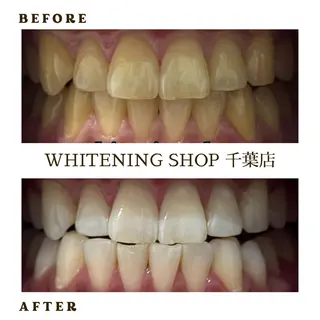 メンズ ホワイトニング ショップ千葉店のその他イメージ