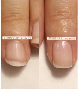 ネイル スリーピーオーブ所属・自爪育成眠れるサロン スリーピーオーブしずのネイルデザイン