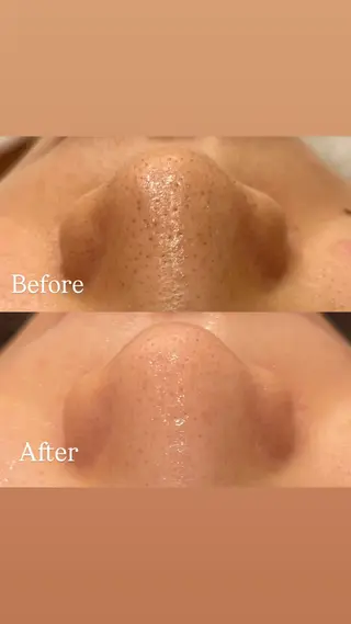 Hari Lounge恵比寿所属・chika🦋 ハリラウンジ恵比寿のエステ・リラクイメージ