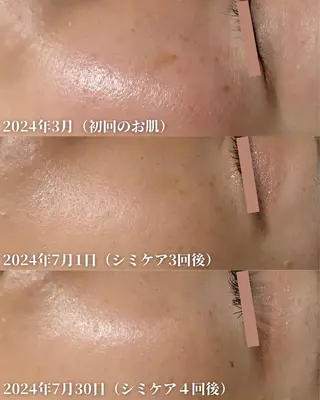 NADEKA所属・河原町NADEKA シミケア/ララピールのエステ・リラクイメージ